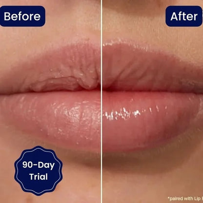 😍BIG SALE 🔥VITAMIN E LIP SERUM
